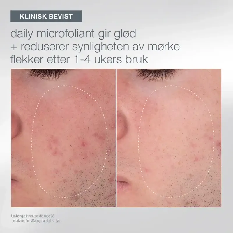 Dermalogica Let it glow  (utsalg)